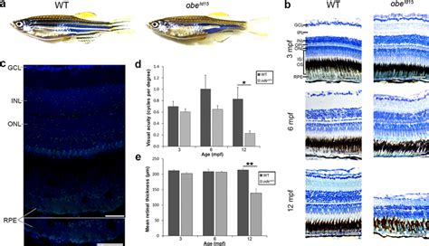 measuring cortical thickness zebrafish|zebrafish optical development.